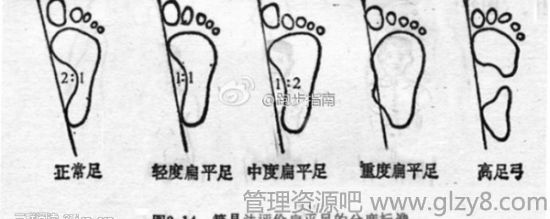 跑鞋的选择技巧