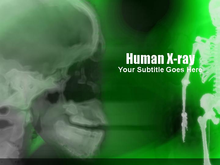 human xrayPPT模板